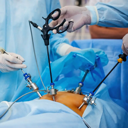 gynaecological surgeries